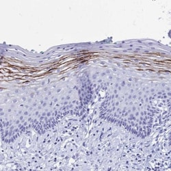 FA2H Antibody, Novus Biologicals 0.1mL; Unlabeled:Antibodies, Polyclonal